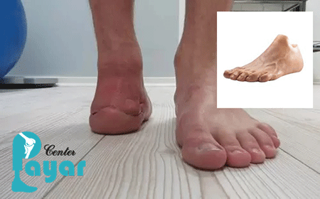 قیمت ساخت پروتز سیلیکونی ساق پا