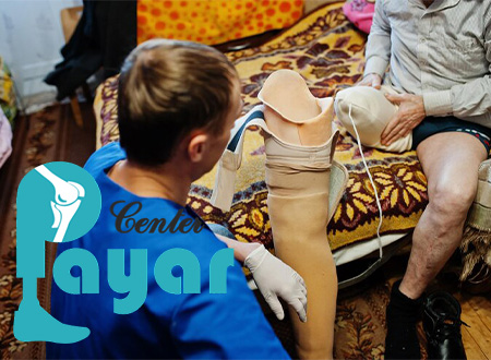 انواع قطع عضو چیست و چه کارهایی برای بهبودی باید انجام داد