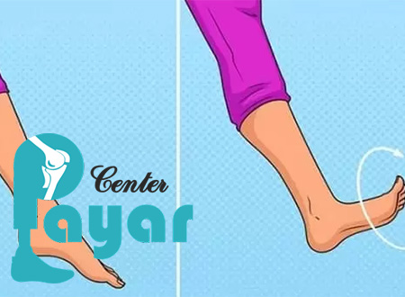 آشنایی با افتادگی پا