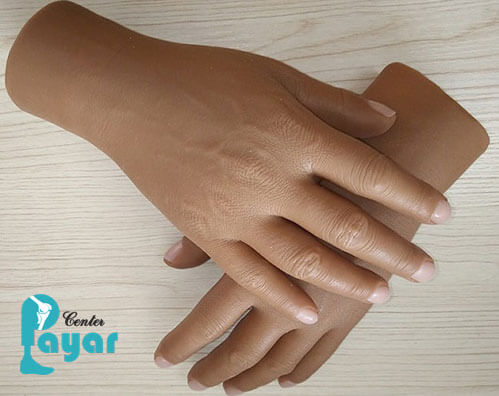 ساخت پروتز مچ دست در کلینیک پایار توسط دکتر کفیلی