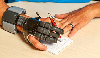 پذیرش پروتز مچ دست