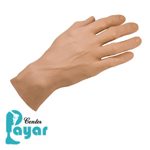 پروتز مچ دست