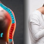 کیفوز چیست؟⭐ (علت و راه درمان کیفوز بدون جراحی)