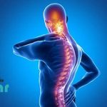 روماتیسم ستون فقرات چیست؟⭐ علائم و روش های درمانی