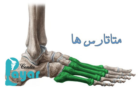 متاتارس چیست؟ نحوه درمان درد های کف پا با پد متاتارس
