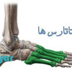 متاتارس چیست؟ درمان درد های کف پا با پد متاتارس