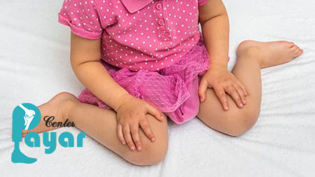 عوارض نشستن به شکل W (دبلیو) در کودک