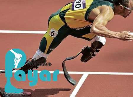 برای طراحی و ساخت پروتز ورزشی چه کنیم؟