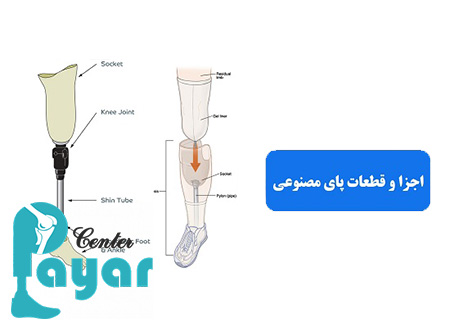 پیشرفته ترین لوازم پروتز پا شامل چه قطعاتی است؟