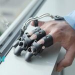 پروتز انگشت دست در اصفهان⭐مراکز پروتز انگشت دست در اصفهان