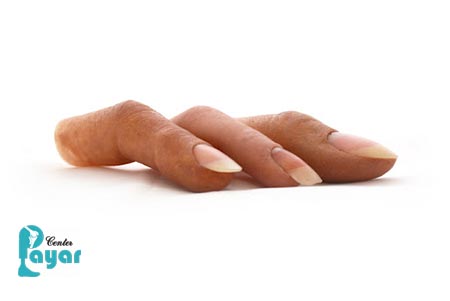 ساختار و قیمت پروتز انگشت سیلیکونی