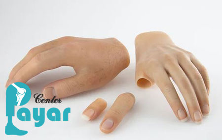 هزینه پروتز انگشت دست نی نی سایت چقدر است؟
