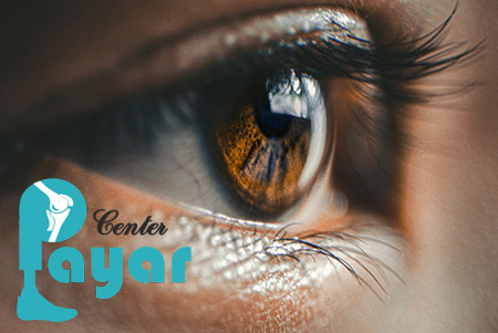 چه کسانی کاندیدای دریافت پروتز چشم بدون تخلیه و مراجعه به مرکز فروش چشم مصنوعی هستند؟