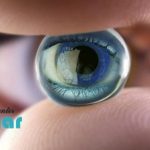 پروتز چشم بدون تخلیه چگونه است؟⚡هر آنچه باید مورد آن بدانید