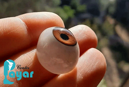 ساخت انواع پروتز چشم در کلینیک پایار