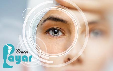 قیمت انواع پروتز چشم در ایران