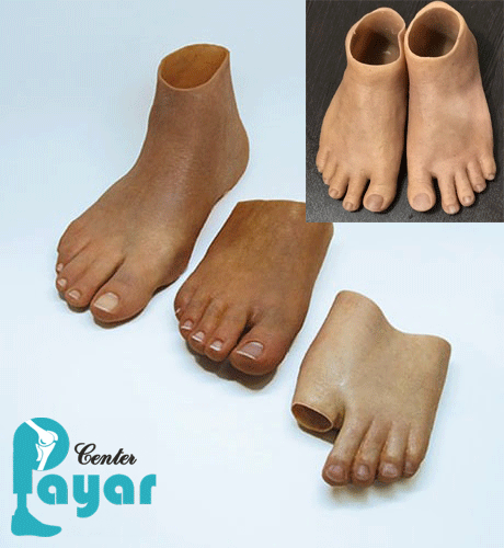 ویژگی های ساخت پروتز زیر زانوی سیلیکونی