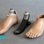پروتز مچ پا چیست؟⭐ و چند نوع دارد؟