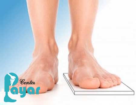 ساخت کفش طبی برای کوتاهی پا با در نظر گرفتن چه مسائلی صورت می گیرد