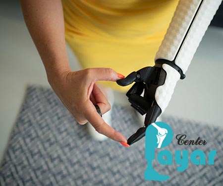 قیمت پروتز مچ دست در کلینیک پایار