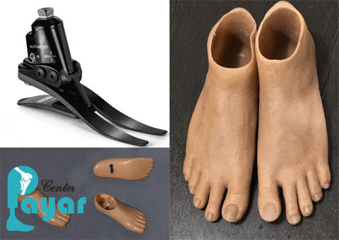 بهترین پروتز پنجه پا چه ویژگی هایی باید داشته باشد