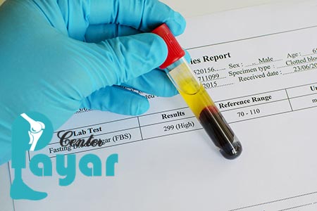 علامت اختصاری دیابت در آزمایش خون