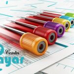 آزمایش قند خون چیست؟⭐قیمت و تفسیر آزمایش قند خون