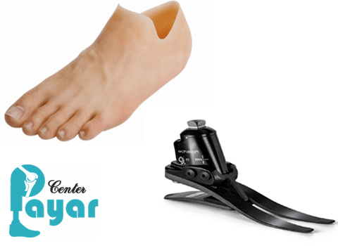 آیا مرکز مناسبی برای ساخت اندام مصنوعی در شیراز است؟