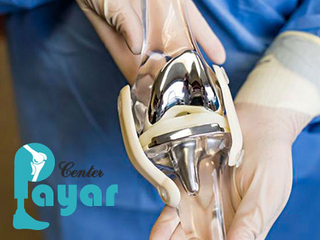 قیمت پروتز زانو در سال 1400