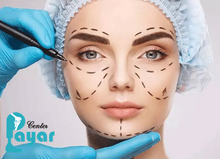 مزیت های پروتز صورت چیست؟