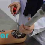هزینه پروتز زانو با بیمه تکمیلی چقدر است؟⭐
