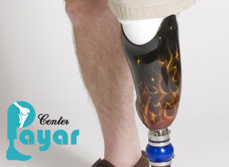در کلینیک تخصصی پا کودکان کدام یک از انواع پاهای مصنوعی ساخته می شود؟
