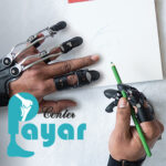 پروتز انگشت دست در مشهد یا در تهران؟⭐به کجا مراجعه کنم؟