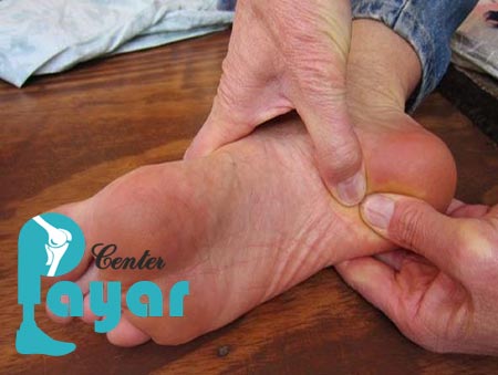 از کجا بفهمیم خار پاشنه داریم؟ روشهای درمان