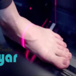 هزینه اسکن کف پا کرج⭐کلینیک پایار ارزان تر از همه جا