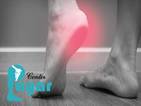 آیا در مورد ایا پیاده روی برای خار پاشنه مضر است چیزی شنیده اید
