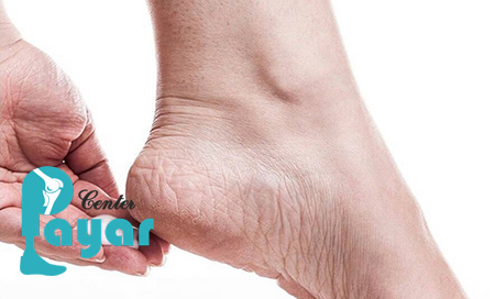 خار پاشنه چیست؟ در مورد آن چه میدانید؟
