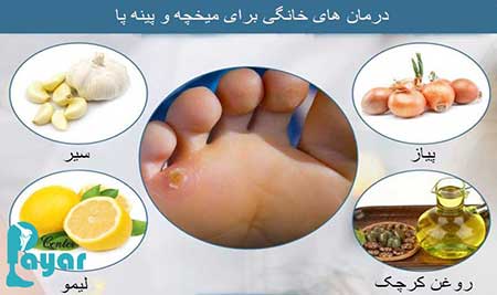 آیا درمان میخچه با سیر امکانپذیر است