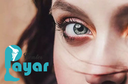 از عوارض پروتز چشم چه میدانید؟