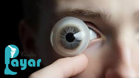 چرا مراجعه به بهترین دکتر پروتز چشم در تهران اهمیت دارد؟
