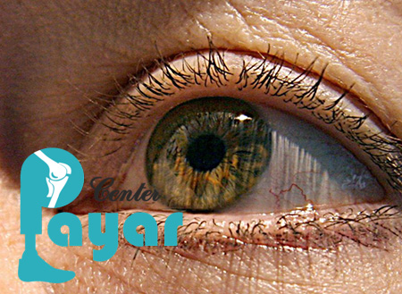 آنچه باید درباره پروتز چشم بدانید.
