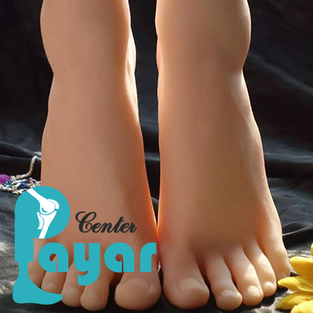 آیا ساخت پروتز انگشت پا جایگزین خوبی برای انگشت قطع شده کودک است؟