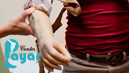 از مشکلات پروتز دست بچه یا پروتز مچ دست کودک چه می دانید؟