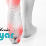 کفش مناسب برای درد پاشنه ⭐ با بهترین متریال و اسکن پا