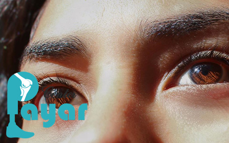 پروتز چشم بدون تخلیه چیست؟