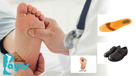 نحوه جلوگیری از قطع پای دیابتی آن را جدی بگیرید