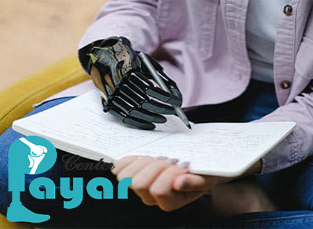 نازلترین قیمت پروتز مچ دست