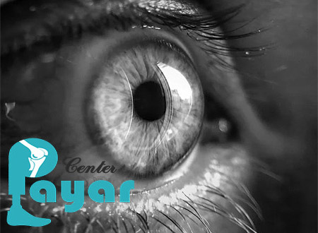 بهترین قیمت پروتز چشم