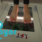هزینه اسکن کف پا چقدر است؟⭐آیا اسکن کف پا لازم است؟