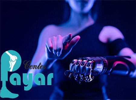 ساخت پروتز انگشت دست چقدر طول میکشد